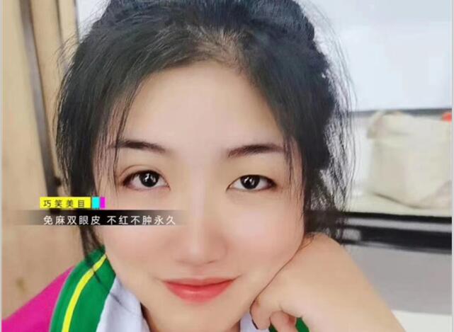 麗竹學(xué)?！凹y繡+雙眼皮”課程開講