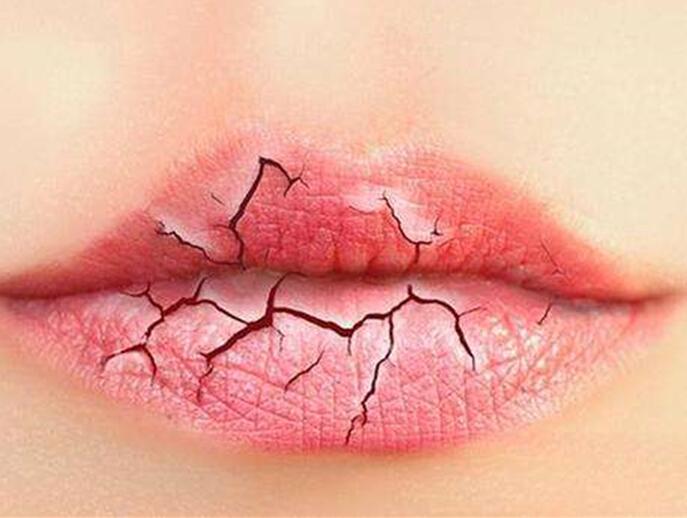 6個(gè)美容技巧，解決秋季嘴唇干燥