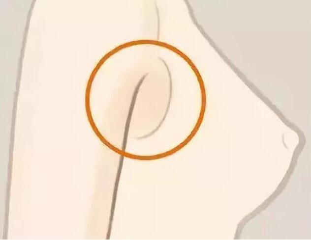 減副乳，瘦手臂一招就解決！