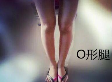 糾正你的腿型！
