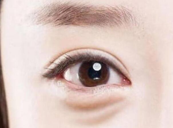 眼袋？淚溝？臥蠶？南寧美容學(xué)校教你辨別
