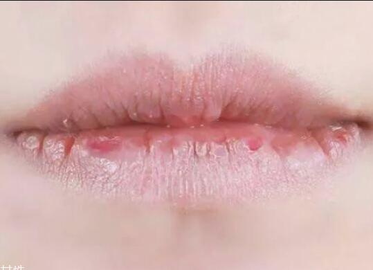 紋唇后嘴巴干燥怎么辦？南寧教紋繡的學(xué)校幫你解決