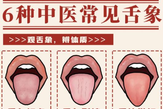 6種常見中醫(yī)舌診判定，快和廣西中醫(yī)美容一起學(xué)