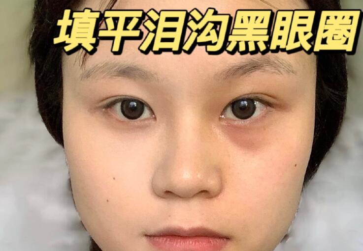 填平淚溝黑眼圈教程，廣西南寧化妝學(xué)校分享