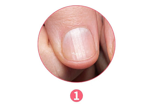 女生氣血不足六大表現(xiàn)，南寧美容養(yǎng)生資訊報道