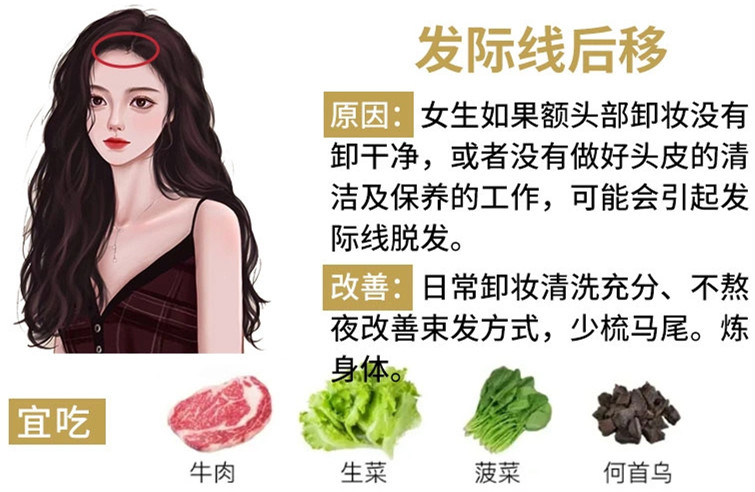 如何改善掉頭發(fā)？南寧頭療養(yǎng)發(fā)護(hù)發(fā)教學(xué)