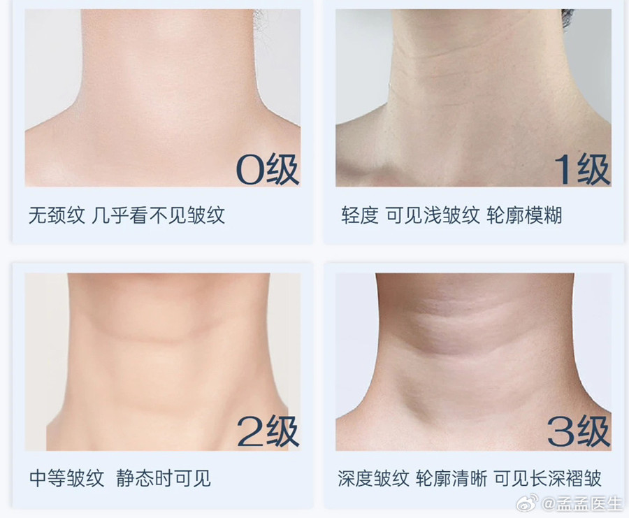 如何緩解頸紋？南寧美體美容管理培訓(xùn)