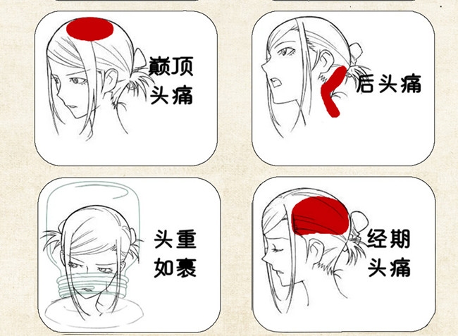 不同頭痛類型經絡護理方法，廣西中醫(yī)美容培訓