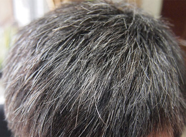 南寧美發(fā)基礎教學：為什么會長白頭發(fā)？