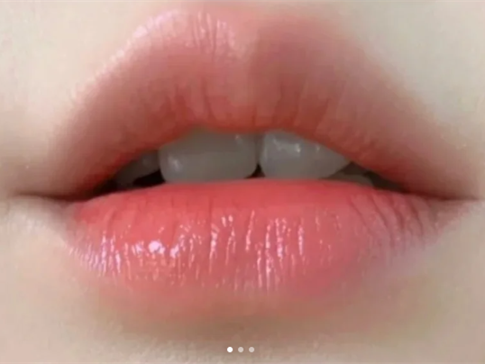 廣西學(xué)紋唇：紋唇遇到組織液時如何應(yīng)付？